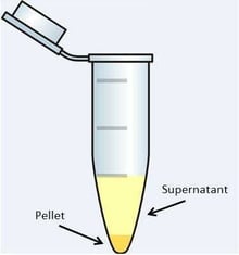 Centrifuge tube showing separation 