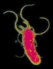 Helicobacter pylori bacterium, magnified.