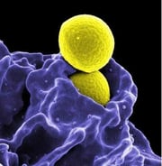 Staph aureus